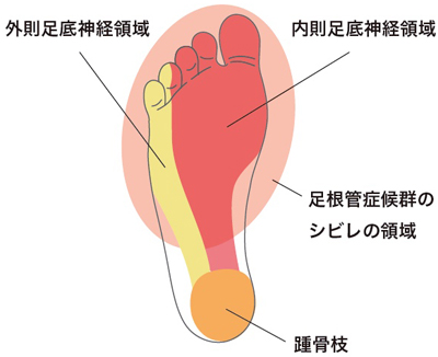 足のしびれ を緩和する脊椎間狭窄症手術後の しびれ など 事務局ブログ 森からの便り