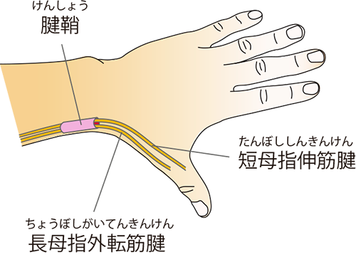 手の親指が痛くて夜も眠れません（ドケルバン病、母指CM関節症）「お灸の治療とセルフケア- 3」 | 事務局ブログ 森からの便り